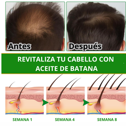 Activa el crecimiento natuaral de tu cabello con el poder del ACEITE DE BATANA