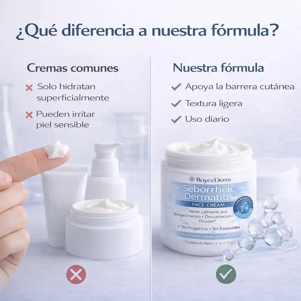 RoyceDerm Seborrheic Dermatitis