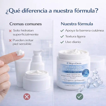 RoyceDerm Seborrheic Dermatitis