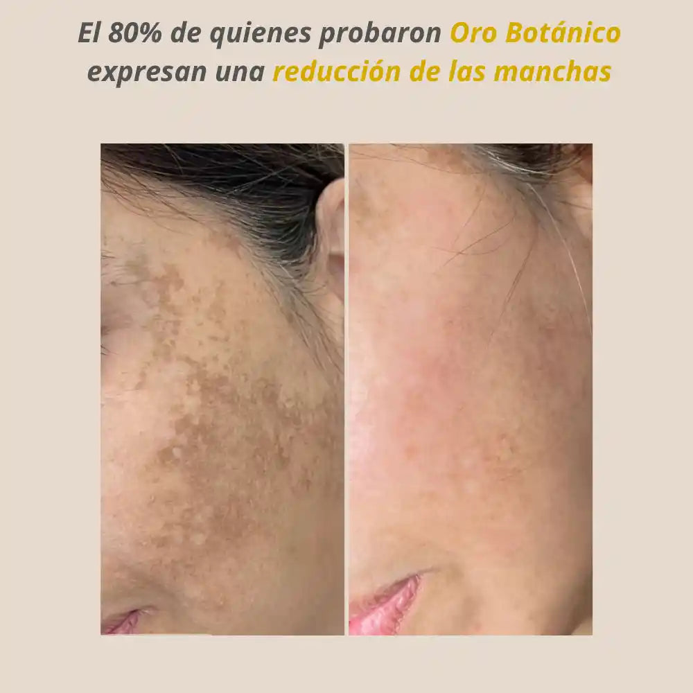 Jabón Oro Botánico